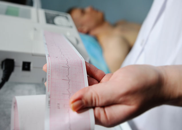 Electrocardiogram (ECG or EKG) Test